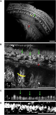 Two Photon Fluorescence Microscopy of the Unstained Human Cochlea Reveals Organ of Corti Cytoarchitecture